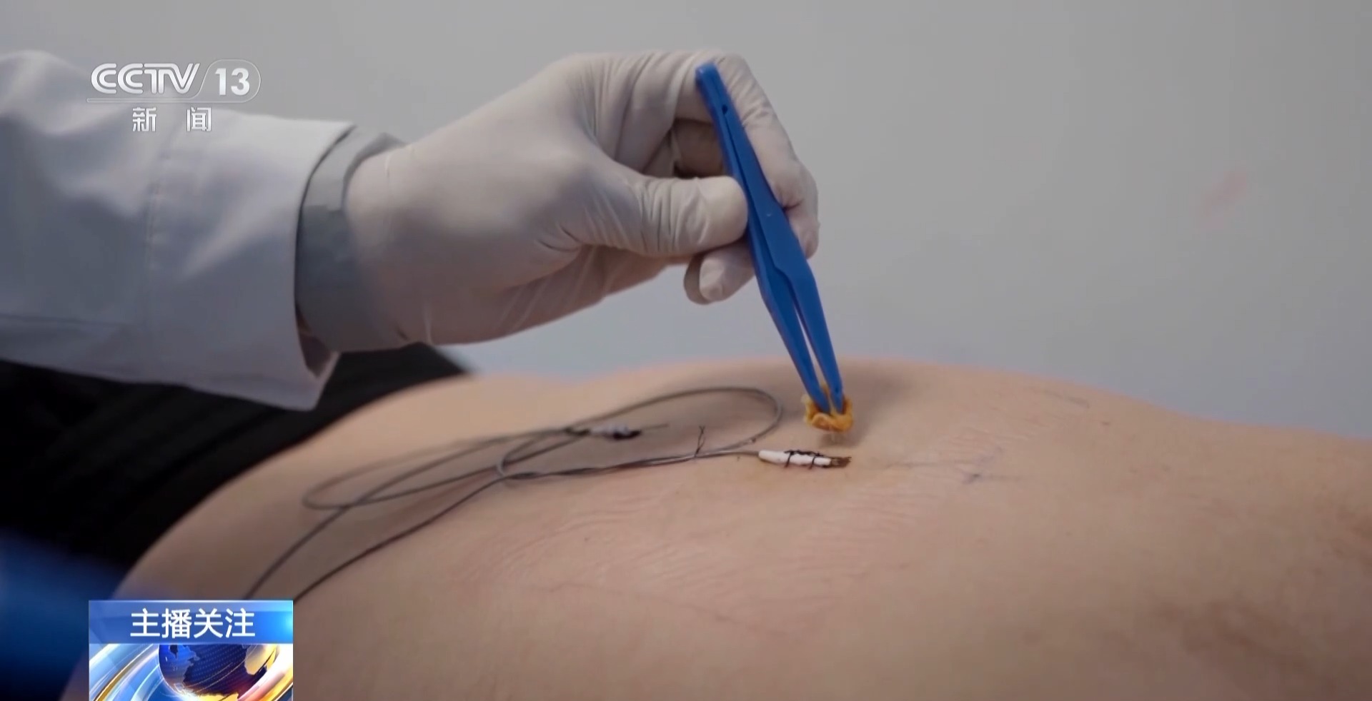 老年人遇到这些身体疼痛勿硬扛 或是健康重要预警信号